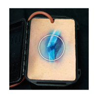 Trenażer tamowania krwotoku – rana odłamkowa (Techline – Shrapnel Wound in a Box®)